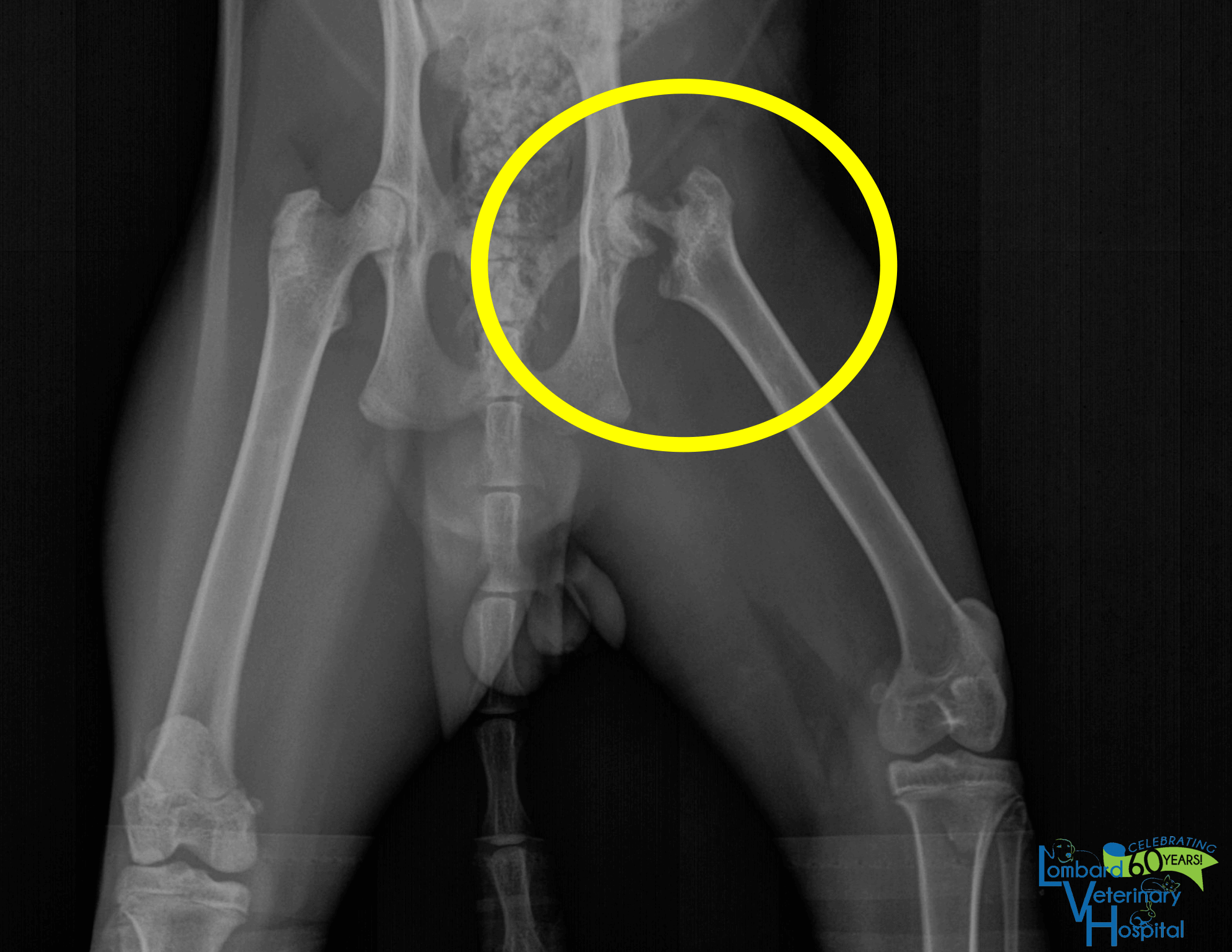 Radiograph of Ragnar's Broken Hip