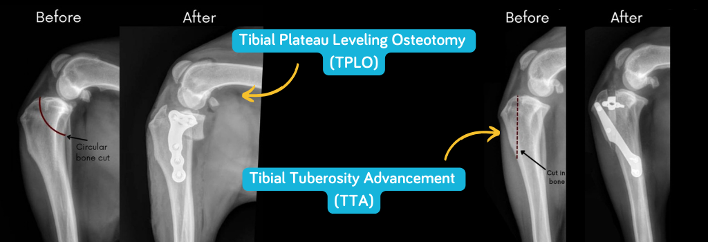 Before and after surgery
